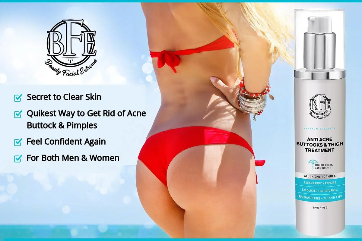 Anti-Acne Buttocks & Thigh Treatment- Clears Away Acne, Pimples, and Ingrown Hairs for the Buttocks and Thigh Area. Prevents Future Breakouts. 6.9 OZ
